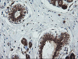 TRIM44 Antibody - IHC of paraffin-embedded Human breast tissue using anti-TRIM44 mouse monoclonal antibody.
