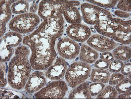 TRIM44 Antibody - IHC of paraffin-embedded Human Kidney tissue using anti-TRIM44 mouse monoclonal antibody.