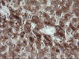 TRIM44 Antibody - IHC of paraffin-embedded Human liver tissue using anti-TRIM44 mouse monoclonal antibody.