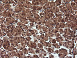TRIM44 Antibody - IHC of paraffin-embedded Human pancreas tissue using anti-TRIM44 mouse monoclonal antibody.