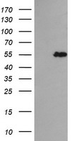 TRIM44 Antibody - HEK293T cells were transfected with the pCMV6-ENTRY control (Left lane) or pCMV6-ENTRY TRIM44 (Right lane) cDNA for 48 hrs and lysed. Equivalent amounts of cell lysates (5 ug per lane) were separated by SDS-PAGE and immunoblotted with anti-TRIM44.