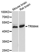 TRIM44 Antibody - Western blot analysis of extracts of various cells.