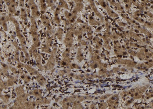 TRIM44 Antibody - 1:100 staining human liver tissue by IHC-P. The sample was formaldehyde fixed and a heat mediated antigen retrieval step in citrate buffer was performed. The sample was then blocked and incubated with the antibody for 1.5 hours at 22°C. An HRP conjugated goat anti-rabbit antibody was used as the secondary.