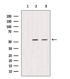 TRIM44 Antibody - Western blot analysis of extracts of various samples using TRIM44 antibody. Lane 1: rat heart treated with blocking peptide. Lane 2: rat heart; Lane 3: HepG2;