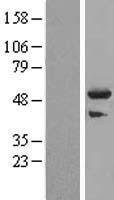 TRIM44 Protein - Western validation with an anti-DDK antibody * L: Control HEK293 lysate R: Over-expression lysate