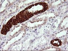 TRIM45 Antibody - IHC of paraffin-embedded Human Kidney tissue using anti-TRIM45 mouse monoclonal antibody. (Heat-induced epitope retrieval by 10mM citric buffer, pH6.0, 120°C for 3min).