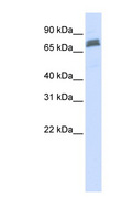 TRIM45 Antibody - TRIM45 antibody Western blot of HeLa lysate. This image was taken for the unconjugated form of this product. Other forms have not been tested.