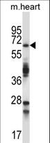 TRIM45 Antibody - TRIM45 Antibody western blot of mouse heart tissue lysates (35 ug/lane). The TRIM45 antibody detected the TRIM45 protein (arrow).