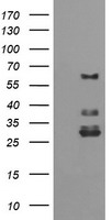 TRIM45 Antibody - E.coli lysate (5 ug, left lane) and E.coli lysate expressing human recombinant protein fragment (5 ug, right lane) corresponding to amino acids 288-580 of human TRIM45(NP_079464) were separated by SDS-PAGE and immunoblotted with anti-TRIM45.