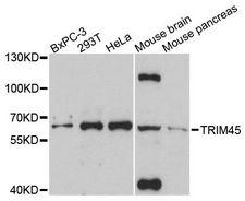 TRIM45 Antibody - Western blot analysis of extracts of various cell lines, using TRIM45 antibody at 1:3000 dilution. The secondary antibody used was an HRP Goat Anti-Rabbit IgG (H+L) at 1:10000 dilution. Lysates were loaded 25ug per lane and 3% nonfat dry milk in TBST was used for blocking. An ECL Kit was used for detection and the exposure time was 90s.