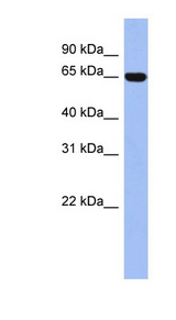 TRIM47 Antibody - TRIM47 antibody Western blot of THP-1 cell lysate. This image was taken for the unconjugated form of this product. Other forms have not been tested.