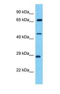 TRIM49 Antibody - Western blot of TRIM49 Antibody with HT1080 Whole Cell lysate.  This image was taken for the unconjugated form of this product. Other forms have not been tested.