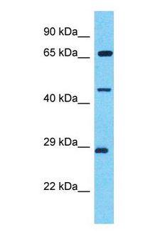 TRIM49 Antibody - Western blot of TRIM49 Antibody with HT1080 Whole Cell lysate.  This image was taken for the unconjugated form of this product. Other forms have not been tested.