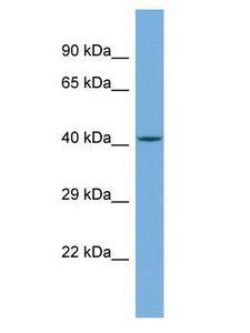 TRIM49C Antibody - TRIM49C antibody Western Blot of Jurkat. Antibody dilution: 1 ug/ml.  This image was taken for the unconjugated form of this product. Other forms have not been tested.
