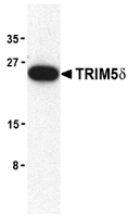 TRIM5 Antibody - Western blot of TRIM5d expression in mouse brain cell lysate with TRIM5d antibody at 2 ug /ml.