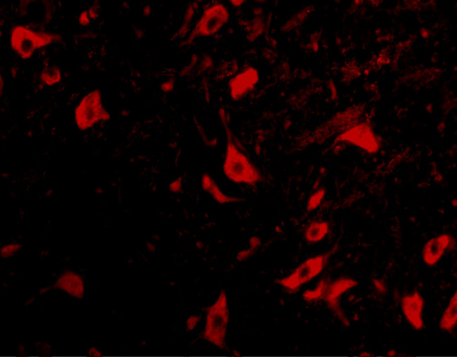 TRIM5 Antibody - Immunofluorescence of TRIM5 delta in mouse brain tissue with TRIM5 delta antibody at 10 ug/mL.