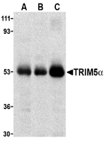 TRIM5 Antibody - Western blot of TRIM5a expression in human stomach (A), thymus (B), and uterus (C) cell lysate with TRIM5a antibody at 2 ug /ml.