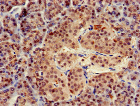 TRIM5 Antibody - Immunohistochemistry of paraffin-embedded human pancreatic tissue at dilution of 1:100