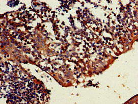 TRIM5 Antibody - Immunohistochemistry of paraffin-embedded human tonsil tissue at dilution of 1:100