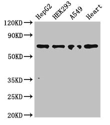 TRIM5 Antibody - Western Blot Positive WB detected in:HepG2 whole cell lysate,HEK293 whole cell lysate,A549 whole cell lysate,Mouse heart tissue All Lanes:TRIM5 antibody at 3µg/ml Secondary Goat polyclonal to rabbit IgG at 1/50000 dilution Predicted band size: 57,47,41,38,32,30 KDa Observed band size: 70 KDa