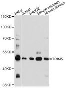 TRIM5 Antibody - Western blot analysis of extracts of various cell lines, using TRIM5 antibody at 1:1000 dilution. The secondary antibody used was an HRP Goat Anti-Rabbit IgG (H+L) at 1:10000 dilution. Lysates were loaded 25ug per lane and 3% nonfat dry milk in TBST was used for blocking. An ECL Kit was used for detection and the exposure time was 60s.
