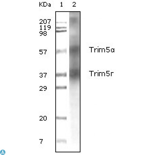 TRIM5 Antibody - Western Blot (WB) analysis using TRIM5alpha Monoclonal Antibody against Human Breast Carcinoma tissue lysate.