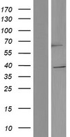 TRIM5 Protein - Western validation with an anti-DDK antibody * L: Control HEK293 lysate R: Over-expression lysate