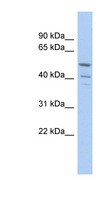 TRIM50 / E3 Ubiquitin Ligase Antibody - TRIM50 antibody Western blot of COLO205 cell lysate. This image was taken for the unconjugated form of this product. Other forms have not been tested.