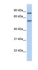 TRIM50 / E3 Ubiquitin Ligase Antibody - TRIM50 antibody Western blot of Jurkat lysate. This image was taken for the unconjugated form of this product. Other forms have not been tested.