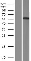 TRIM50 / E3 Ubiquitin Ligase Protein - Western validation with an anti-DDK antibody * L: Control HEK293 lysate R: Over-expression lysate