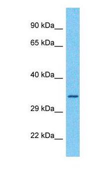 TRIM52 Antibody - Western blot of TRI52 Antibody with human Ovary Tumor lysate.  This image was taken for the unconjugated form of this product. Other forms have not been tested.
