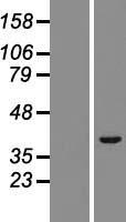 TRIM52 Protein - Western validation with an anti-DDK antibody * L: Control HEK293 lysate R: Over-expression lysate
