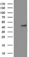 TRIM54 / MURF Antibody - HEK293T cells were transfected with the pCMV6-ENTRY control (Left lane) or pCMV6-ENTRY TRIM54 (Right lane) cDNA for 48 hrs and lysed. Equivalent amounts of cell lysates (5 ug per lane) were separated by SDS-PAGE and immunoblotted with anti-TRIM54.