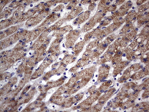 TRIM54 / MURF Antibody - IHC of paraffin-embedded Human liver tissue using anti-TRIM54 mouse monoclonal antibody. (Heat-induced epitope retrieval by 1 mM EDTA in 10mM Tris, pH8.5, 120°C for 3min).