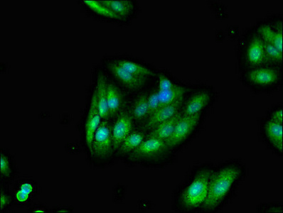 TRIM54 / MURF Antibody - Immunofluorescent analysis of HepG2 cells diluted at 1:100 and Alexa Fluor 488-congugated AffiniPure Goat Anti-Rabbit IgG(H+L)