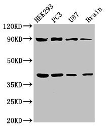 TRIM54 / MURF Antibody - Western Blot Positive WB detected in:HEK293 whole cell lysate,PC3 whole cell lysate,U87 whole cell lysate,Rat brain tissue All Lanes:TRIM54 antibody at 3µg/ml Secondary Goat polyclonal to rabbit IgG at 1/50000 dilution Predicted band size: 41,45 KDa Observed band size: 41,90 KDa