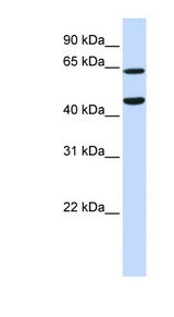 TRIM54 / MURF Antibody - TRIM54 antibody Western blot of HeLa lysate. This image was taken for the unconjugated form of this product. Other forms have not been tested.