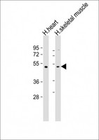 TRIM55 / MURF2 Antibody - All lanes: Anti-TRIM55 Antibody (Center) at 1:2000 dilution. Lane 1: human heart lysate. Lane 2: human skeletal muscle lysate Lysates/proteins at 20 ug per lane. Secondary Goat Anti-Rabbit IgG, (H+L), Peroxidase conjugated at 1:10000 dilution. Predicted band size: 60 kDa. Blocking/Dilution buffer: 5% NFDM/TBST.