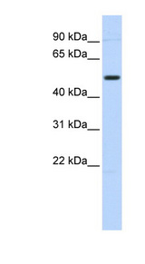 TRIM55 / MURF2 Antibody - TRIM55 antibody Western blot of HeLa lysate. This image was taken for the unconjugated form of this product. Other forms have not been tested.