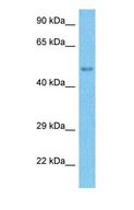 TRIM55 / MURF2 Antibody - Western blot of TRI55 Antibody with human Fetal Lung lysate.  This image was taken for the unconjugated form of this product. Other forms have not been tested.