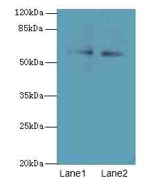 TRIM55 / MURF2 Antibody - Western blot. All lanes: TRIM55 antibody at 1 ug/ml. Lane 1: HeLa whole cell lysate. Lane 2: Mouse liver tissue. Secondary Goat polyclonal to Rabbit IgG at 1:10000 dilution. Predicted band size: 60 kDa. Observed band size: 60 kDa.