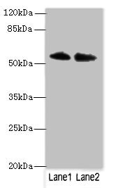 TRIM55 / MURF2 Antibody - Western blot All lanes: TRIM55 antibody at 1µg/ml Lane 1: Hela whole cell lysate Lane 2: Mouse liver tissue Secondary Goat polyclonal to rabbit IgG at 1/10000 dilution Predicted band size: 61, 51, 27 kDa Observed band size: 61 kDa