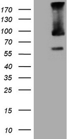 TRIM56 Antibody - HEK293T cells were transfected with the pCMV6-ENTRY control. (Left lane) or pCMV6-ENTRY TRIM56. (Right lane) cDNA for 48 hrs and lysed