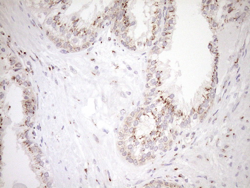 TRIM56 Antibody - Immunohistochemical staining of paraffin-embedded Human prostate tissue within the normal limits using anti-TRIM56 mouse monoclonal antibody. (Heat-induced epitope retrieval by 1mM EDTA in 10mM Tris buffer. (pH8.5) at 120°C for 3 min. (1:150)
