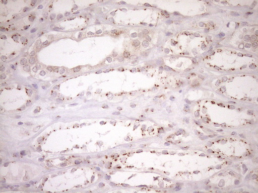 TRIM56 Antibody - Immunohistochemical staining of paraffin-embedded Human Kidney tissue within the normal limits using anti-TRIM56 mouse monoclonal antibody. (Heat-induced epitope retrieval by 1mM EDTA in 10mM Tris buffer. (pH8.5) at 120°C for 3 min. (1:150)