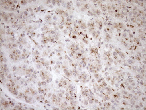 TRIM56 Antibody - Immunohistochemical staining of paraffin-embedded Human liver tissue within the normal limits using anti-TRIM56 mouse monoclonal antibody. (Heat-induced epitope retrieval by 1mM EDTA in 10mM Tris buffer. (pH8.5) at 120°C for 3 min. (1:150)