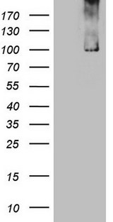 TRIM56 Antibody - HEK293T cells were transfected with the pCMV6-ENTRY control. (Left lane) or pCMV6-ENTRY TRIM56. (Right lane) cDNA for 48 hrs and lysed. Equivalent amounts of cell lysates. (5 ug per lane) were separated by SDS-PAGE and immunoblotted with anti-TRIM56. (1:2000)