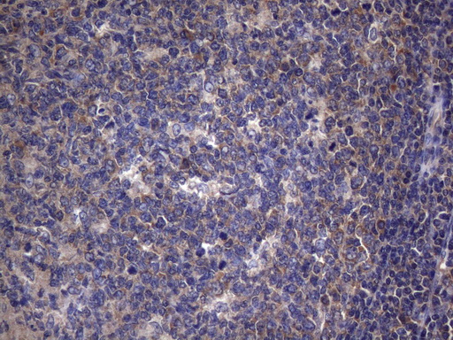 TRIM56 Antibody - Immunohistochemical staining of paraffin-embedded Human tonsil within the normal limits using anti-TRIM56 mouse monoclonal antibody. (Heat-induced epitope retrieval by 1mM EDTA in 10mM Tris buffer. (pH8.5) at 120°C for 3 min. (1:150)
