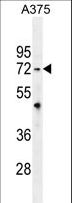 TRIM56 Antibody - TRIM56 Antibody western blot of A375 cell line lysates (35 ug/lane). The TRIM56 antibody detected the TRIM56 protein (arrow).