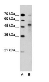 TRIM59 Antibody - A: Marker, B: Jurkat Cell Lysate.  This image was taken for the unconjugated form of this product. Other forms have not been tested.